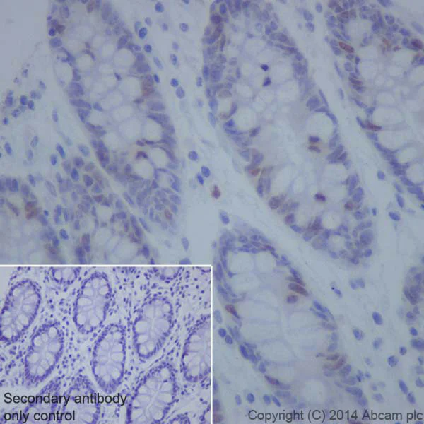 Immunohistochemistry (Formalin/PFA-fixed paraffin-embedded sections) - Anti-Topoisomerase II alpha antibody [EP1102Y] - BSA and Azide free (AB181828)