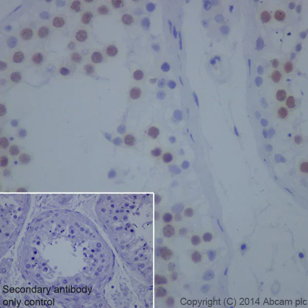 Immunohistochemistry (Formalin/PFA-fixed paraffin-embedded sections) - Anti-Topoisomerase II alpha antibody [EP1102Y] - BSA and Azide free (AB181828)