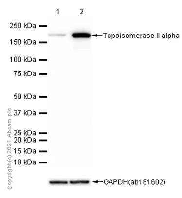 Western blot - Anti-Topoisomerase II alpha antibody [EP1102Y] - BSA and Azide free (AB181828)