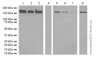 Western blot - Anti-Topoisomerase II alpha antibody [EP1102Y] - BSA and Azide free (AB181828)