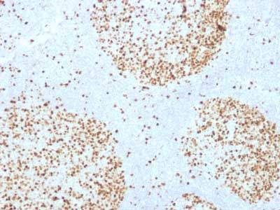 Immunohistochemistry (Formalin/PFA-fixed paraffin-embedded sections) - Anti-Topoisomerase II alpha antibody [TOP2A/1361] (AB219320)
