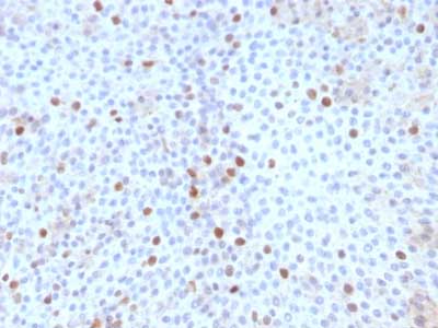 Immunohistochemistry (Formalin/PFA-fixed paraffin-embedded sections) - Anti-Topoisomerase II alpha antibody [TOP2A/1361] (AB219320)