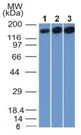 Western blot - Anti-Topoisomerase II alpha antibody [TOP2A/1361] (AB219320)