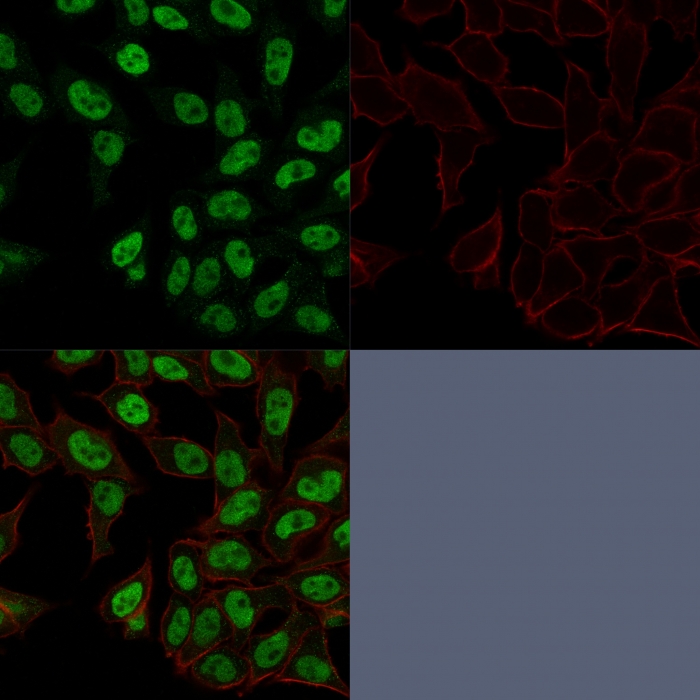 Immunocytochemistry - Anti-Topoisomerase II alpha antibody [TOP2A/1362] (AB219321), expandable thumbnail
