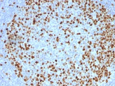Immunohistochemistry (Formalin/PFA-fixed paraffin-embedded sections) - Anti-Topoisomerase II alpha antibody [TOP2A/1362] (AB219321), expandable thumbnail
