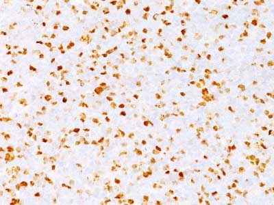 Immunohistochemistry (Formalin/PFA-fixed paraffin-embedded sections) - Anti-Topoisomerase II alpha antibody [TOP2A/1362] (AB219321), expandable thumbnail