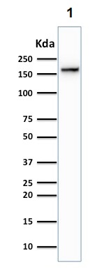 Western blot - Anti-Topoisomerase II alpha antibody [TOP2A/1362] (AB219321), expandable thumbnail
