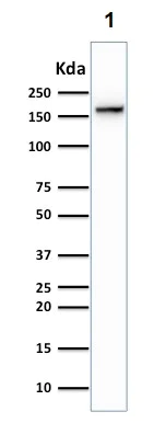 Western blot - Anti-Topoisomerase II alpha antibody [TOP2A/1362] (AB219321)