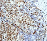 Immunohistochemistry (Formalin/PFA-fixed paraffin-embedded sections) - Anti-Topoisomerase II alpha (phospho S1106) antibody [EP2722] (AB75765)
