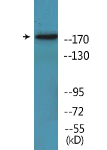 Western blot - Anti-Topoisomerase II alpha (phospho S1525) antibody (AB138683)
