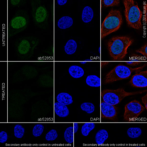 Immunocytochemistry/ Immunofluorescence - Anti-Topoisomerase II alpha (phospho T1343) antibody [EP1054Y] (AB52853), expandable thumbnail
