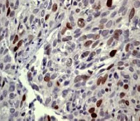 Immunohistochemistry (Formalin/PFA-fixed paraffin-embedded sections) - Anti-Topoisomerase II alpha (phospho T1343) antibody [EP1054Y] (AB52853)