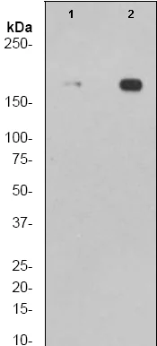 Western blot - Anti-Topoisomerase II alpha (phospho T1343) antibody [EP1054Y] (AB52853)