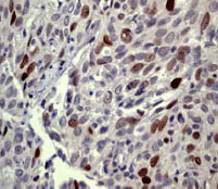 Immunohistochemistry (Formalin/PFA-fixed paraffin-embedded sections) - Anti-Topoisomerase II alpha (phospho T1343) antibody [EP1054Y] - BSA and Azide free (AB247333)