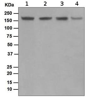Western blot - Anti-Topoisomerase II alpha + Topoisomerase II beta/TOP2B antibody [EPR5377] (AB109524)