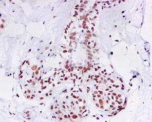 Immunohistochemistry (Formalin/PFA-fixed paraffin-embedded sections) - Anti-Topoisomerase II alpha + Topoisomerase II beta/TOP2B antibody [EPR5377] - BSA and Azide free (AB239984)