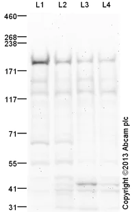 Western blot - Anti-Topoisomerase II beta/TOP2B antibody (AB125297)