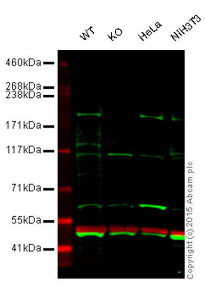 Western blot - Anti-Topoisomerase II beta/TOP2B antibody (AB125297)