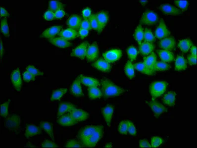 Immunocytochemistry/ Immunofluorescence - Anti-Topoisomerase II beta/TOP2B antibody (AB235898)