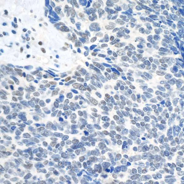 Immunohistochemistry (Formalin/PFA-fixed paraffin-embedded sections) - Anti-Topoisomerase II beta/TOP2B antibody (AB264158)