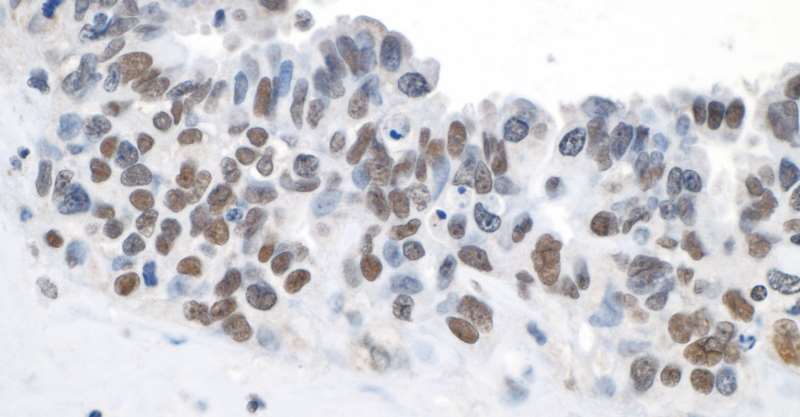 Immunohistochemistry (Formalin/PFA-fixed paraffin-embedded sections) - Anti-Topoisomerase II beta/TOP2B antibody (AB264158)