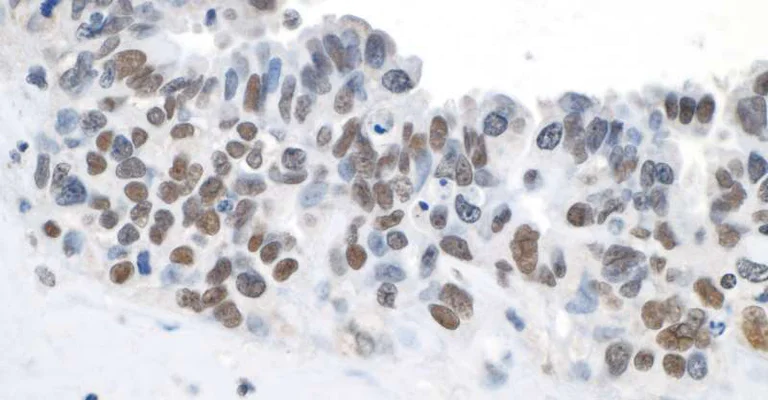 Immunohistochemistry (Formalin/PFA-fixed paraffin-embedded sections) - Anti-Topoisomerase II beta/TOP2B antibody (AB264158)