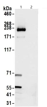 Immunoprecipitation - Anti-Topoisomerase II beta/TOP2B antibody (AB264158)