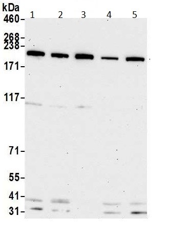 Western blot - Anti-Topoisomerase II beta/TOP2B antibody (AB264158)