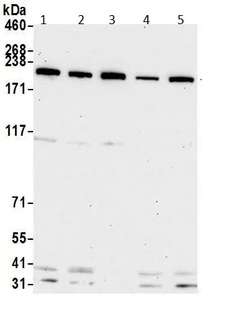 Western blot - Anti-Topoisomerase II beta/TOP2B antibody (AB264158)