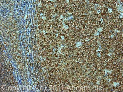 Immunohistochemistry (Formalin/PFA-fixed paraffin-embedded sections) - Anti-Topoisomerase II beta/TOP2B antibody (AB72334)