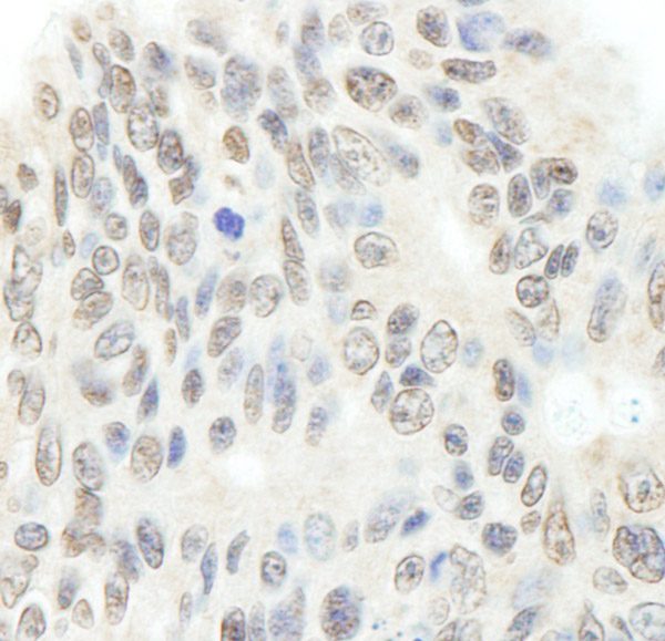 Immunohistochemistry (Formalin/PFA-fixed paraffin-embedded sections) - Anti-Topoisomerase II beta/TOP2B antibody (AB72334)