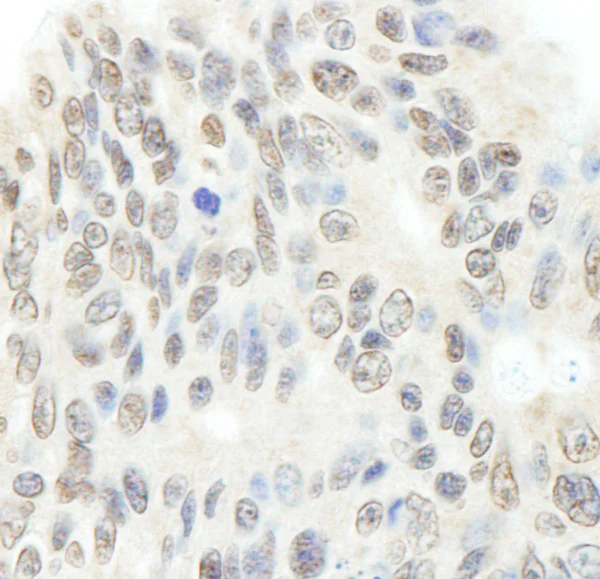 Immunohistochemistry (Formalin/PFA-fixed paraffin-embedded sections) - Anti-Topoisomerase II beta/TOP2B antibody (AB72334)