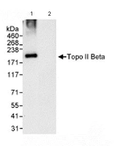 Immunoprecipitation - Anti-Topoisomerase II beta/TOP2B antibody (AB72334)
