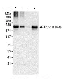 Western blot - Anti-Topoisomerase II beta/TOP2B antibody (AB72334)
