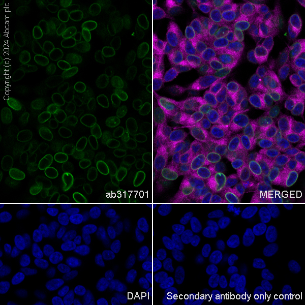 Immunocytochemistry/ Immunofluorescence - Anti-TOR1AIP1 antibody [EPR29003-34] (AB317701), expandable thumbnail