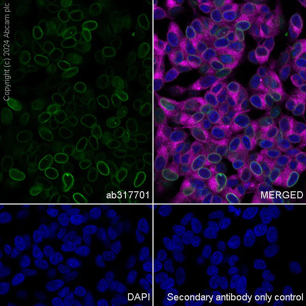 Immunocytochemistry/ Immunofluorescence - Anti-TOR1AIP1 antibody [EPR29003-34] (AB317701)