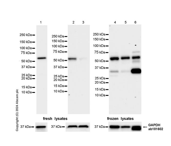 Western blot - Anti-TOR1AIP1 antibody [EPR29003-34] - BSA and Azide free (AB317702)