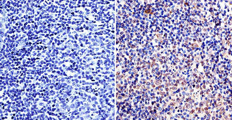 Immunohistochemistry (Formalin/PFA-fixed paraffin-embedded sections) - Anti-TOR1AIP1 antibody [RL13] (AB2737)