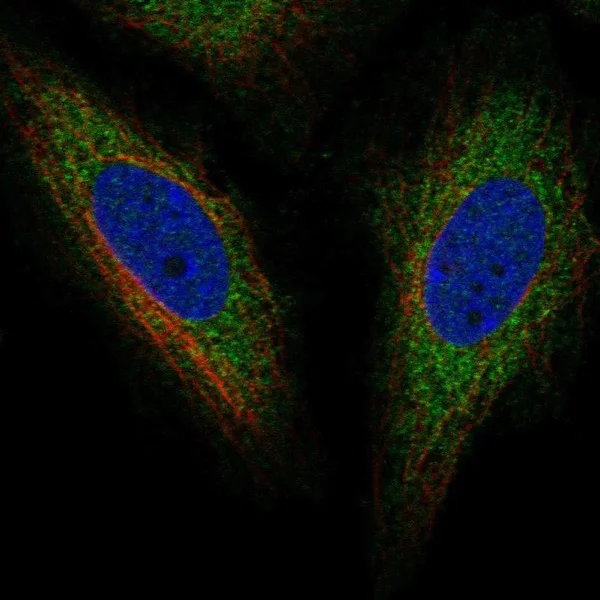 Immunocytochemistry/ Immunofluorescence - Anti-TOR1AIP2 antibody (AB221808)