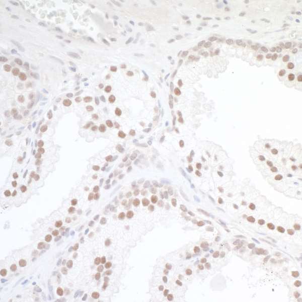 Immunohistochemistry (Formalin/PFA-fixed paraffin-embedded sections) - Anti-TORC1 antibody (AB264144)