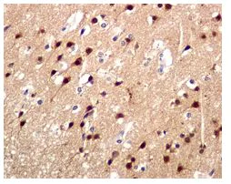 Immunohistochemistry (Formalin/PFA-fixed paraffin-embedded sections) - Anti-TORC1 antibody [EPR3381(2)] - BSA and Azide free (AB247919)