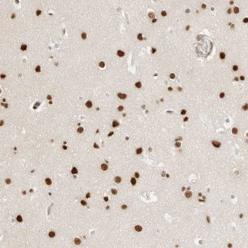 Immunohistochemistry (Formalin/PFA-fixed paraffin-embedded sections) - Anti-TORC2 antibody (AB244418)