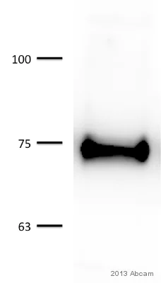 Western blot - Anti-TORC2 antibody [EPR3384(2)] (AB109081)
