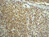 Immunohistochemistry (Formalin/PFA-fixed paraffin-embedded sections) - Anti-TORC2 antibody [EPR3384(2)] - BSA and Azide free (AB232244)