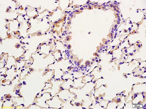 Immunohistochemistry (Formalin/PFA-fixed paraffin-embedded sections) - Anti-TORC2 (phospho S171) antibody (AB203187)