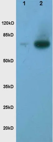 Western blot - Anti-TORC2 (phospho S171) antibody (AB203187)