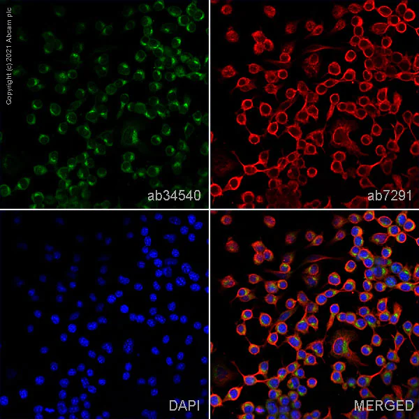 Immunocytochemistry/ Immunofluorescence - Anti-Torsin A/DYT1 antibody (AB34540)