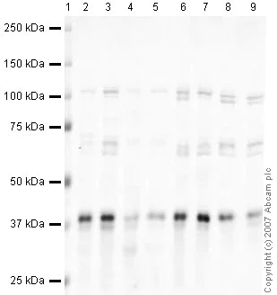 Western blot - Anti-Torsin A/DYT1 antibody (AB34540)