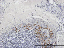 Immunohistochemistry (Formalin/PFA-fixed paraffin-embedded sections) - Anti-TOSO antibody (AB168968)