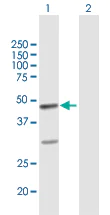 Western blot - Anti-TOSO antibody (AB168968)
